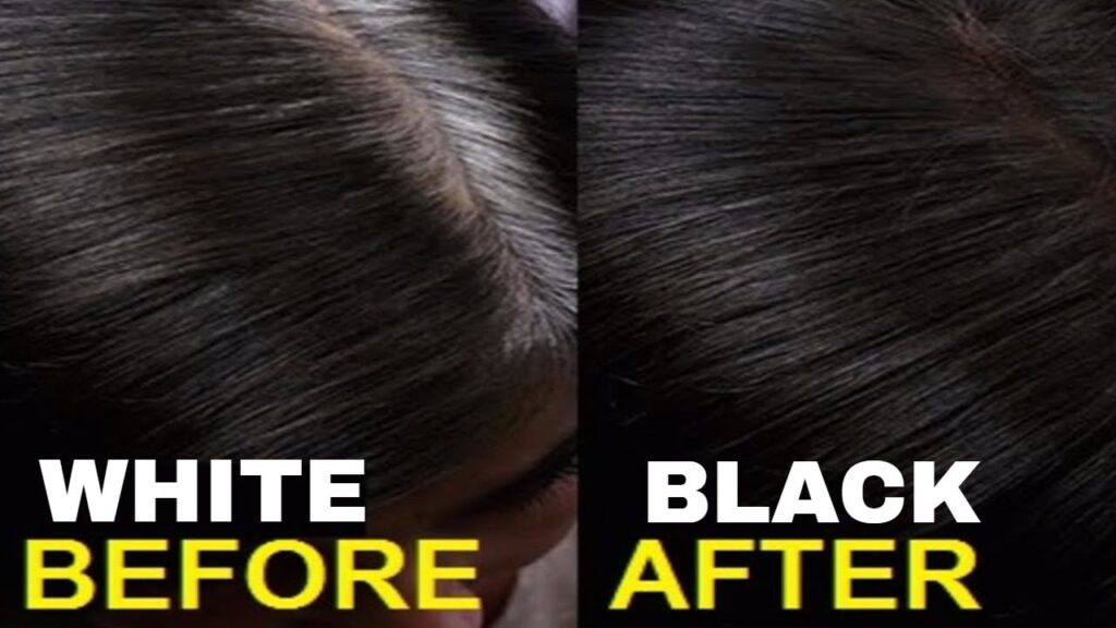 white hair to black remedy